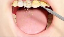 Free TEETH cleaning   Cash giveaway