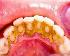 free teeth cleaning and get paid