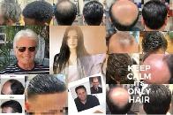 Now hiring! Hair replacement technician