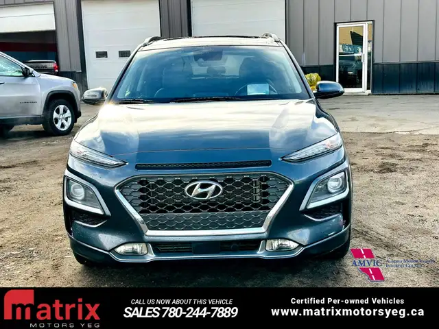 2020 Hyundai Kona Ultimate - Photo 3