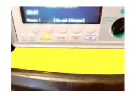 ZOLL E SERIES DEFIBRILLATION MONITOR FRENCH LANGUAGE - Photo 9