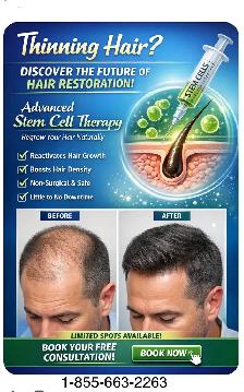 Stem Cell Hair Restoration