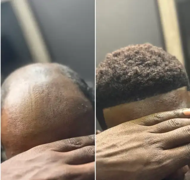 10% Men Hair Piece/ Toupee - Photo 2