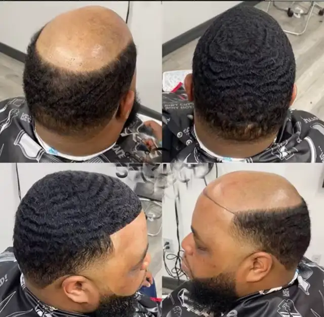 10% Men Hair Piece/ Toupee - Photo 3