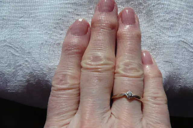 BAGUE OR 10 K. ( 2 tons ) sertie de 10 PTS , Diamants Canadiens - Photo 2