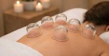 New Facial Treatment & Cupping Therapy in Downtown Burlington - Photo 4