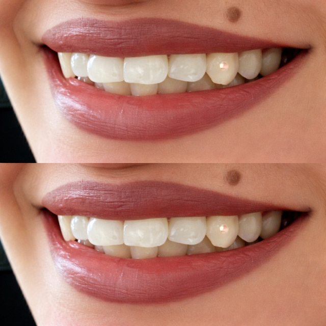 Lash set model call $100, tooth gems $40 - Photo 10