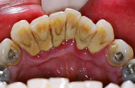 FREE DENTAL HYGIENE SERVICES