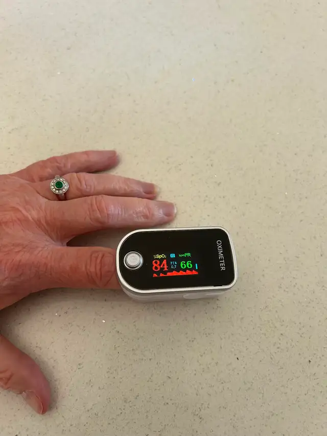 Pulse Oximeter Fingertip - Photo 2
