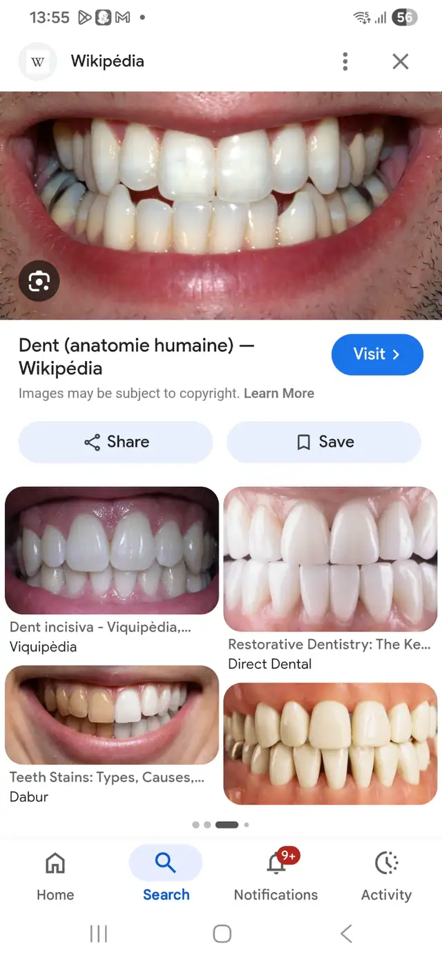 Tourisme dentaire, faites vos dents en 29 jours , avion, hotel