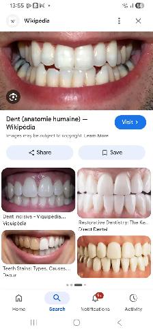 Tourisme dentaire, faites vos dents en 29 jours , avion, hotel