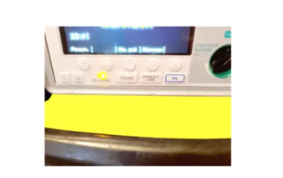 ZOLL E SERIES DEFIBRILLATION MONITOR FRENCH LANGUAGE - Photo 3