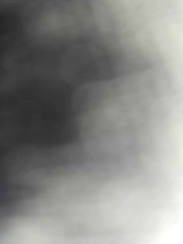 Grand 3 ½ à louer près de l'hôpital Maisonneuve-Rosemont