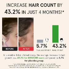 iRestore Essential - Laser Red Light Therapy for Hair Growth - Photo 3