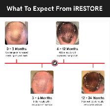 iRestore Essential - Laser Red Light Therapy for Hair Growth - Photo 4