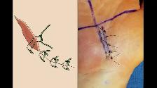 WOUNDCARE, IV, PHLEBOTOMYEKG IM INJECTION - CERTIFICATE PROGRAMS - Photo 6