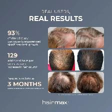 Hairmax Laser Hair Growth Comb Ultima 9 Classic - Photo 4