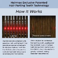 Hairmax Laser Hair Growth Comb Ultima 9 Classic - Photo 5