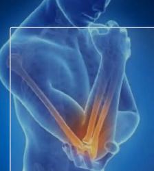 PRP injection / Sports Injury / Joint Injection - Photo 2