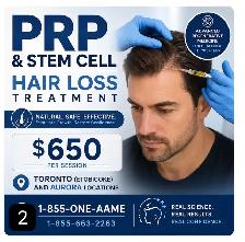 Hair Fall PRP / stem cell treatment - Photo 2