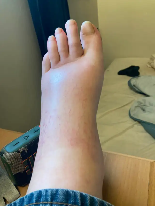 I’m looking for some Detox foot pads