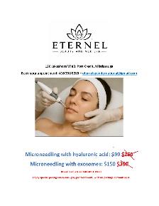 Microneedling special, with hyaluronic acid $99