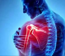 PRP injections / joint injections - Photo 3