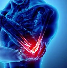 PRP Joint Injections