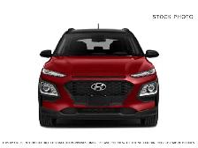 2020 Hyundai Kona - Photo 2
