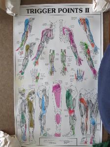 TRIGGER POINT CHART - Photo 2