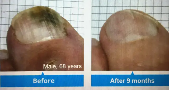 Looking for a Room to Rent for Foot Care Services – North London