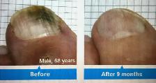 Looking for a Room to Rent for Foot Care Services – North London