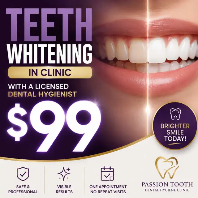 $99 Teeth Whitening   Includes Take Home Whitening Pen