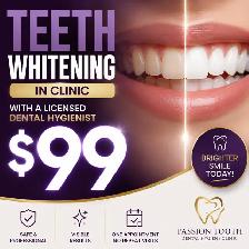 $99 Teeth Whitening   Includes Take Home Whitening Pen