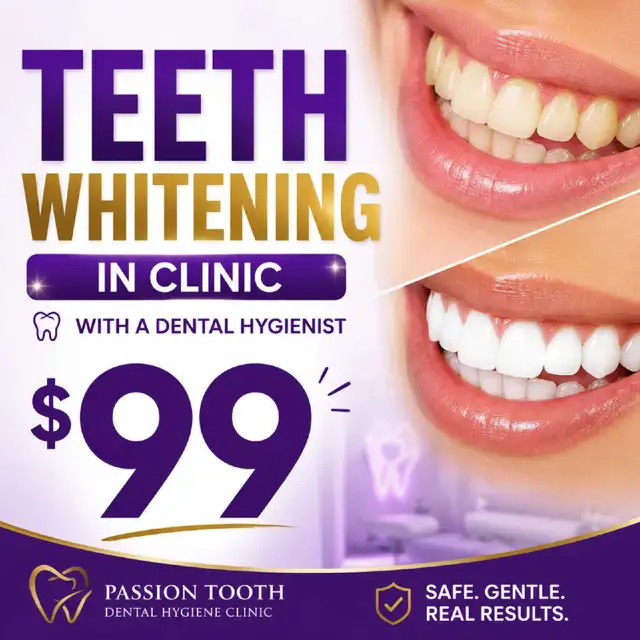 Professional Teeth Whitening Plus Take Home Whitening Pen