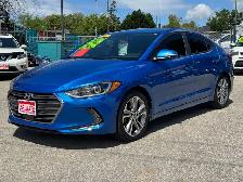2018 Hyundai Elantra GLS - Photo 3