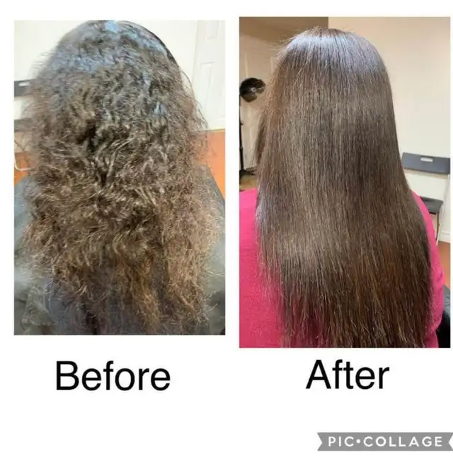 Botox Treatment $200