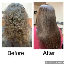Botox Treatment $200