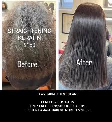Botox Treatment $200 - Photo 4