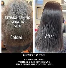 Botox Treatment $200 - Photo 5
