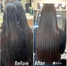 Botox Treatment $200 - Photo 6