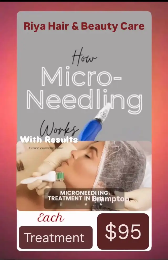 Micronddling Treatment $95