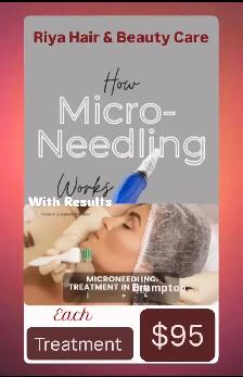 Micronddling Treatment $95