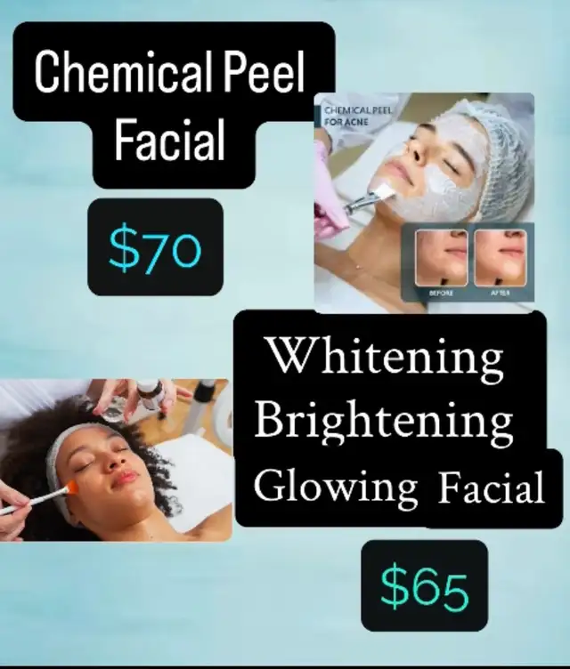 Chemical peel Facial  $65