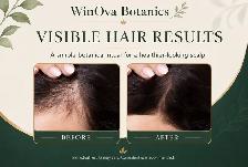 WinOva Botanics 100% Pure Rosemary Hair Oil 200ml - Photo 4