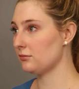 Permanent Fat Loss for stubborn fat. - Photo 7