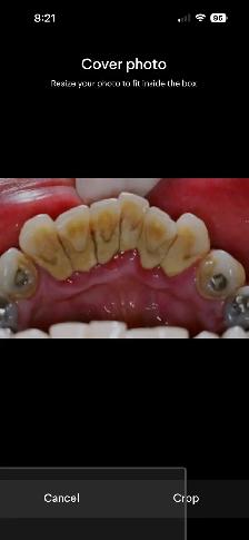 free dental care