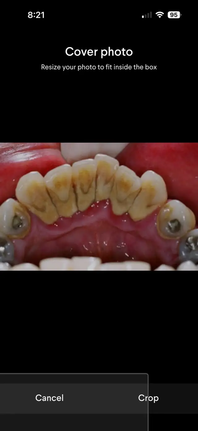 free dental care