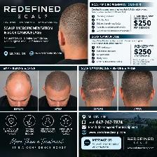 SCALP MICROPIGMENTATION & SCAR CAMOUFLAGE | MILTON