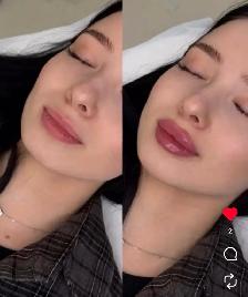 Natural Lips Filler